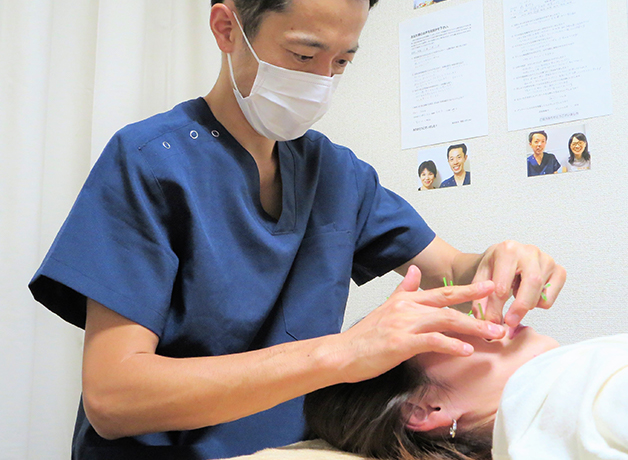 太くて長い鍼を深く刺すことで、お顔の筋肉を刺激するから